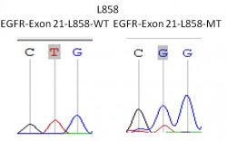EGFR-EXON-21-1
