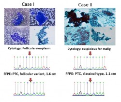 braf mutation cytology